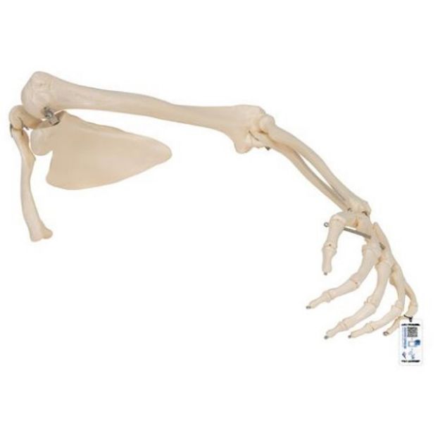Afbeeldingen van Arm met scapula en clavicula